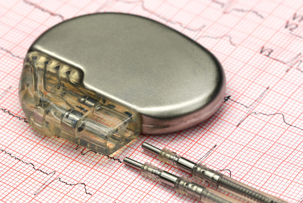 Pacemaker Implantation